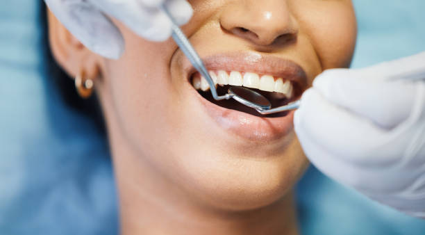 Best Emergency Wisdom Teeth Removal in Fall River, WI
